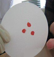 血痕样本采集方法